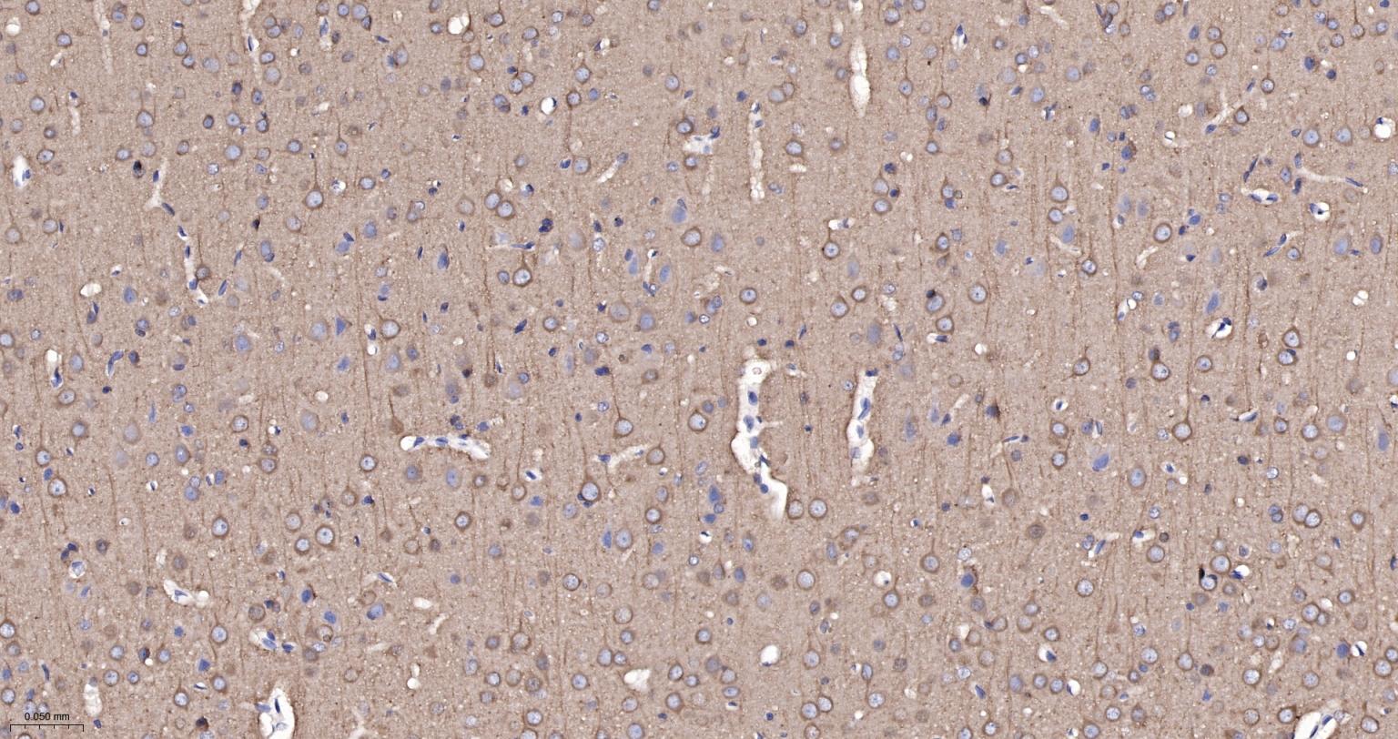 微管蛋白α/Tubulin α/α-tubulin单克隆抗体