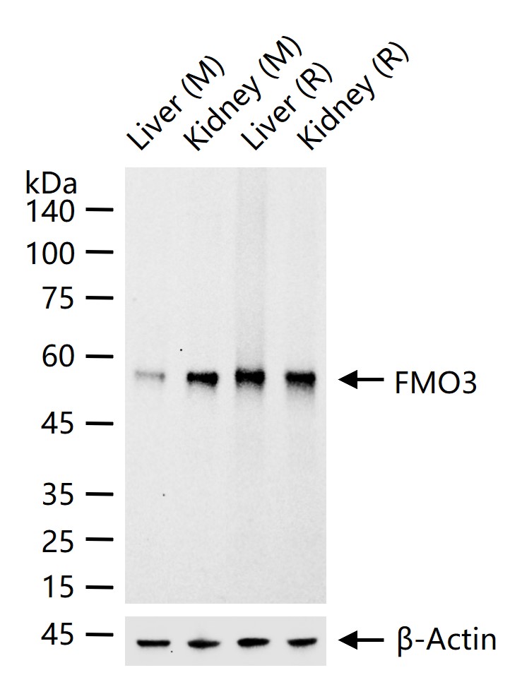 FMO3 Recombinant Rabbit mAb (一抗) - WB,IHC-P,IHC-F,IF,ICC/IF | Bioss