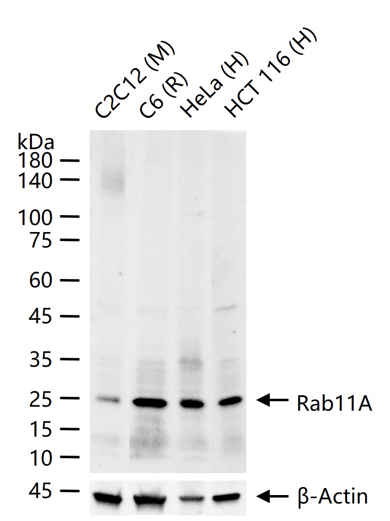 Rab11A Recombinant Rabbit mAb (一抗) - WB,IP | Bioss