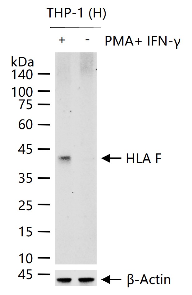 组织相容性抗原HLAF重组兔单抗