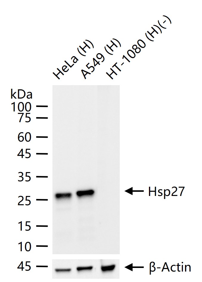 热休克蛋白27重组兔单抗