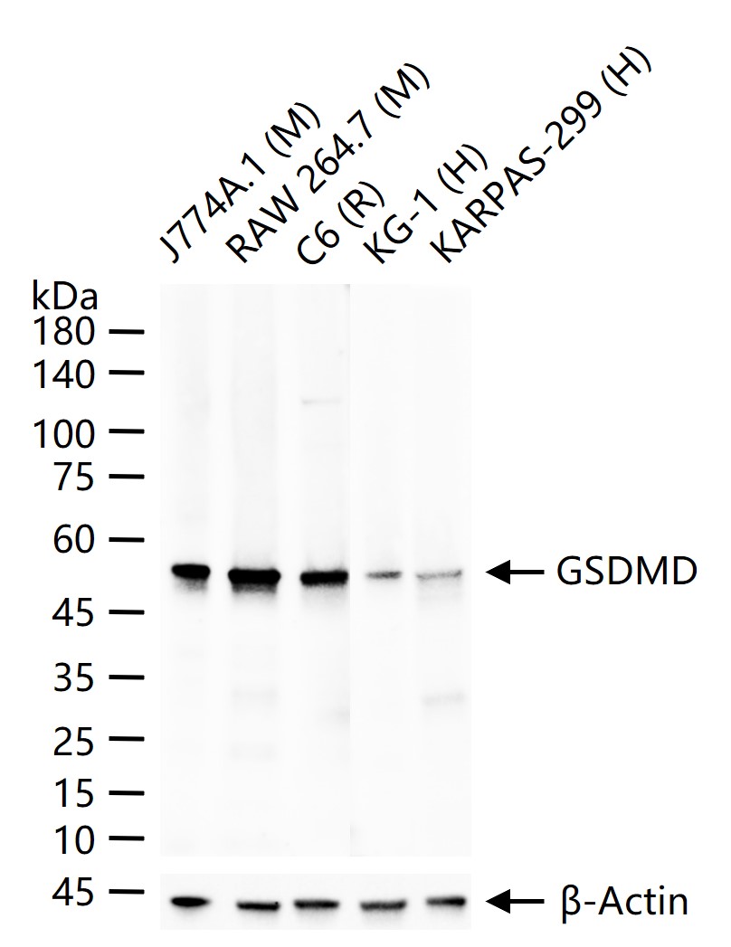 Gasdermin D蛋白抗体-bs-14287R