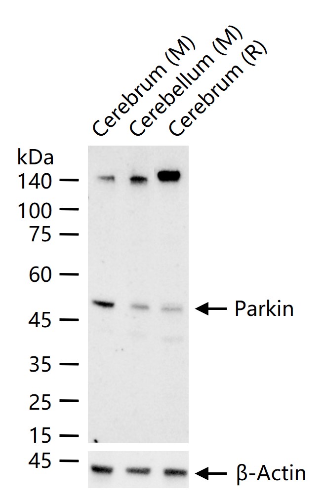 帕金蛋白重组兔单抗