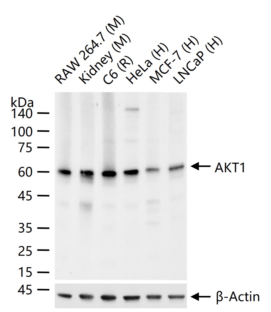 蛋白激酶B重组兔单抗