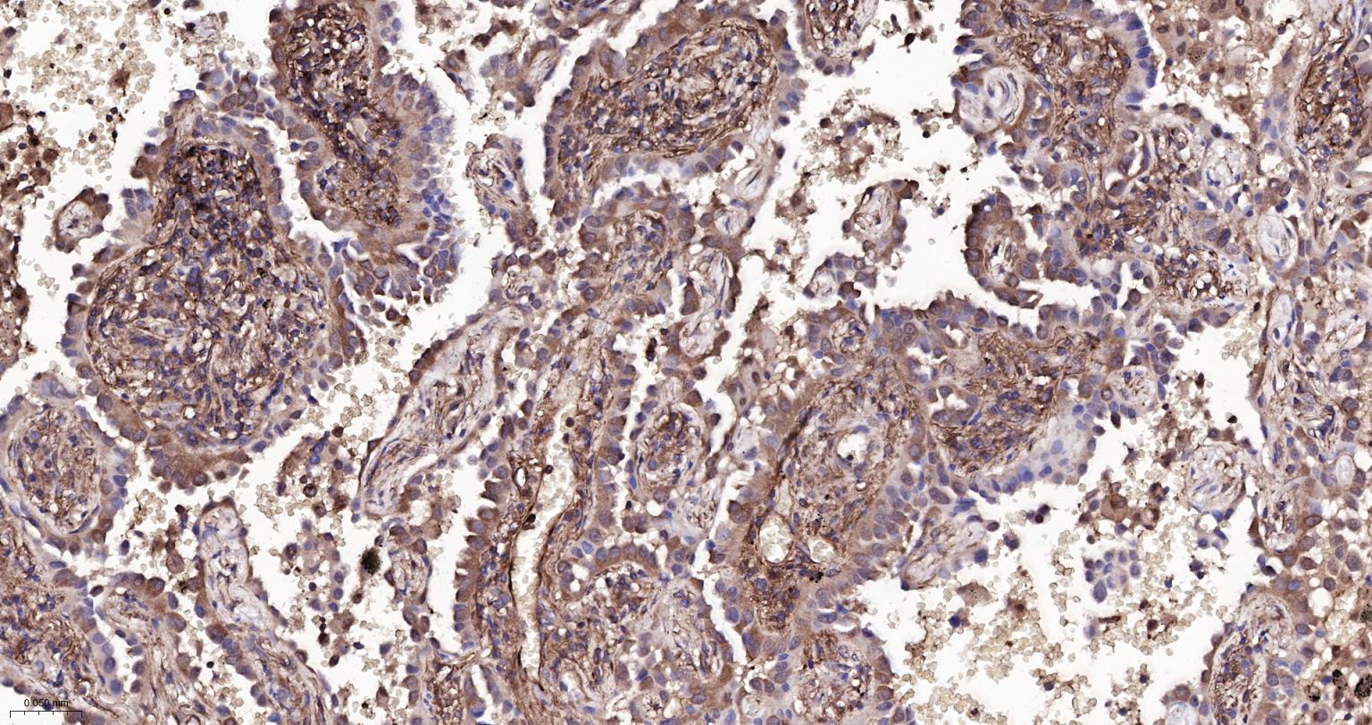 细胞核因子/k基因结合核因子重组兔单抗