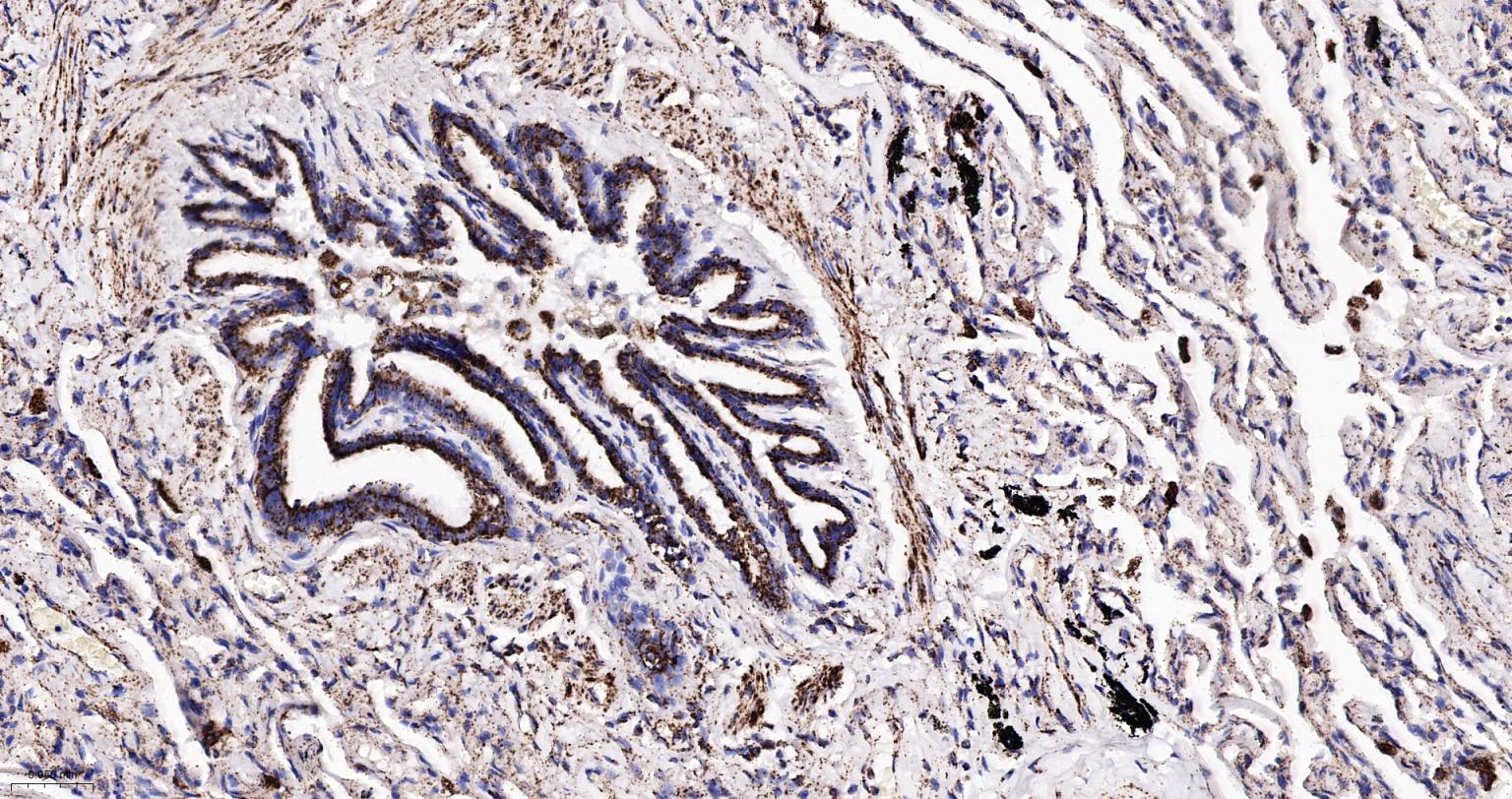 热休克蛋白-60/groEL重组兔单抗