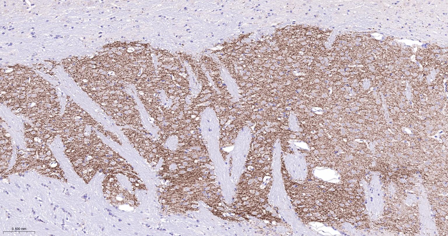 酪氨酸羟化酶兔单克隆抗体