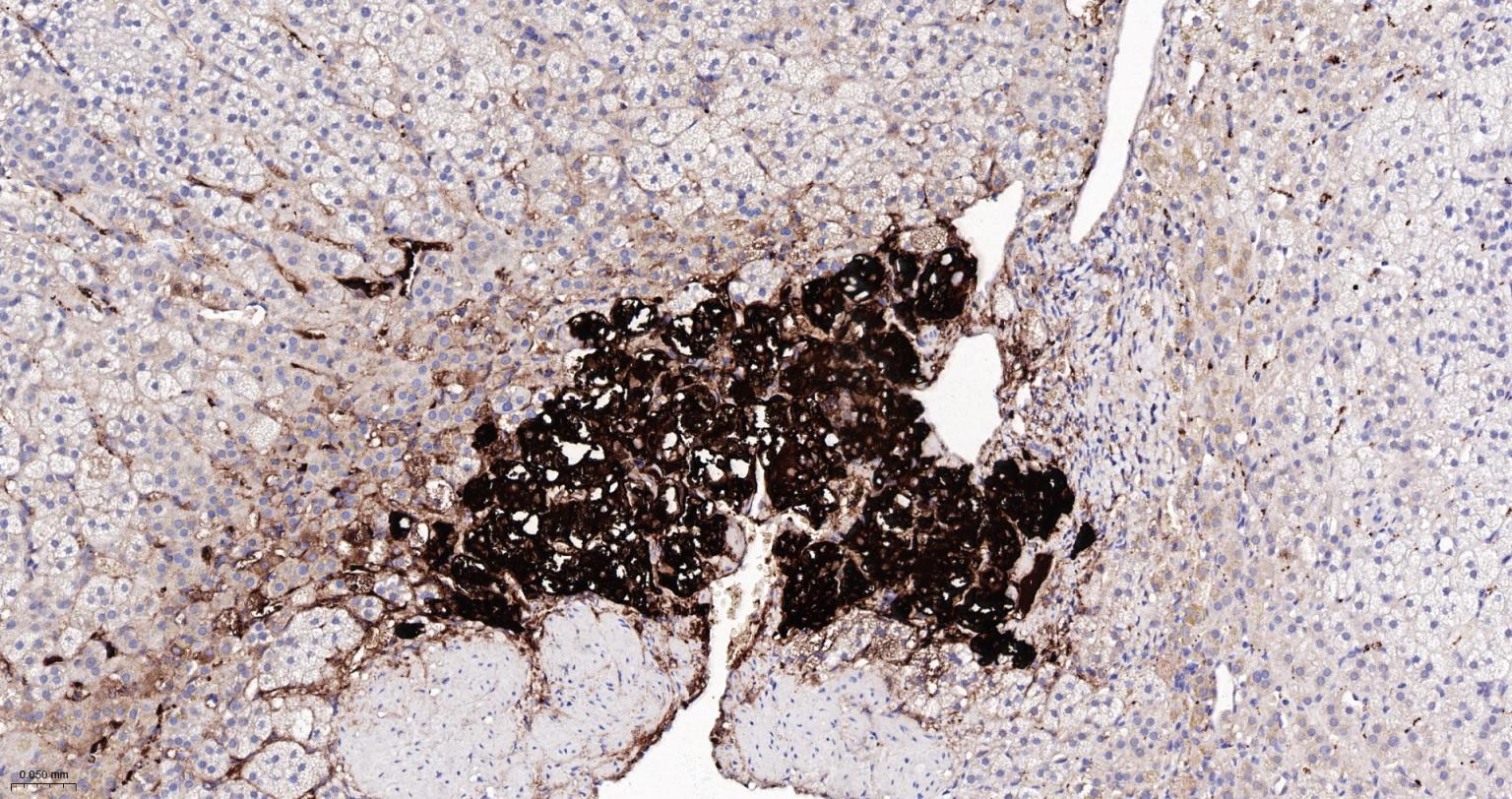 酪氨酸羟化酶兔单克隆抗体