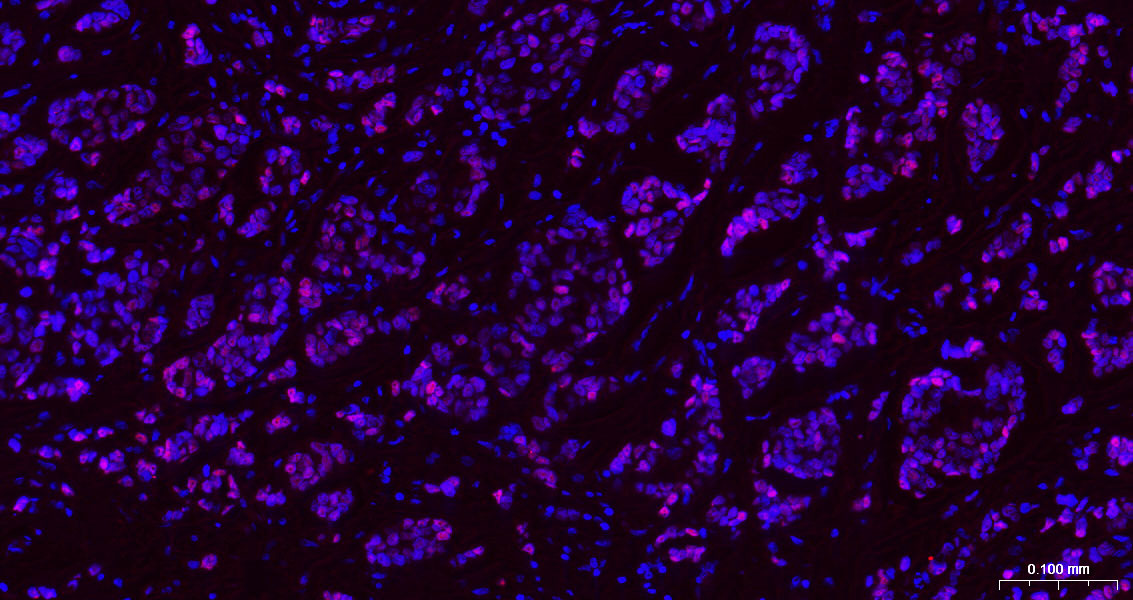 GATA结合蛋白3重组兔单克隆抗体
