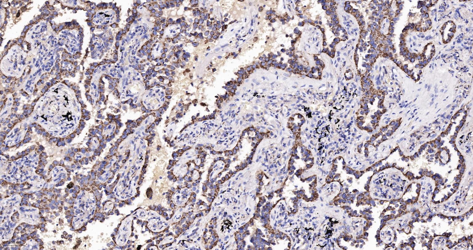 热休克蛋白-60/groEL重组兔单抗