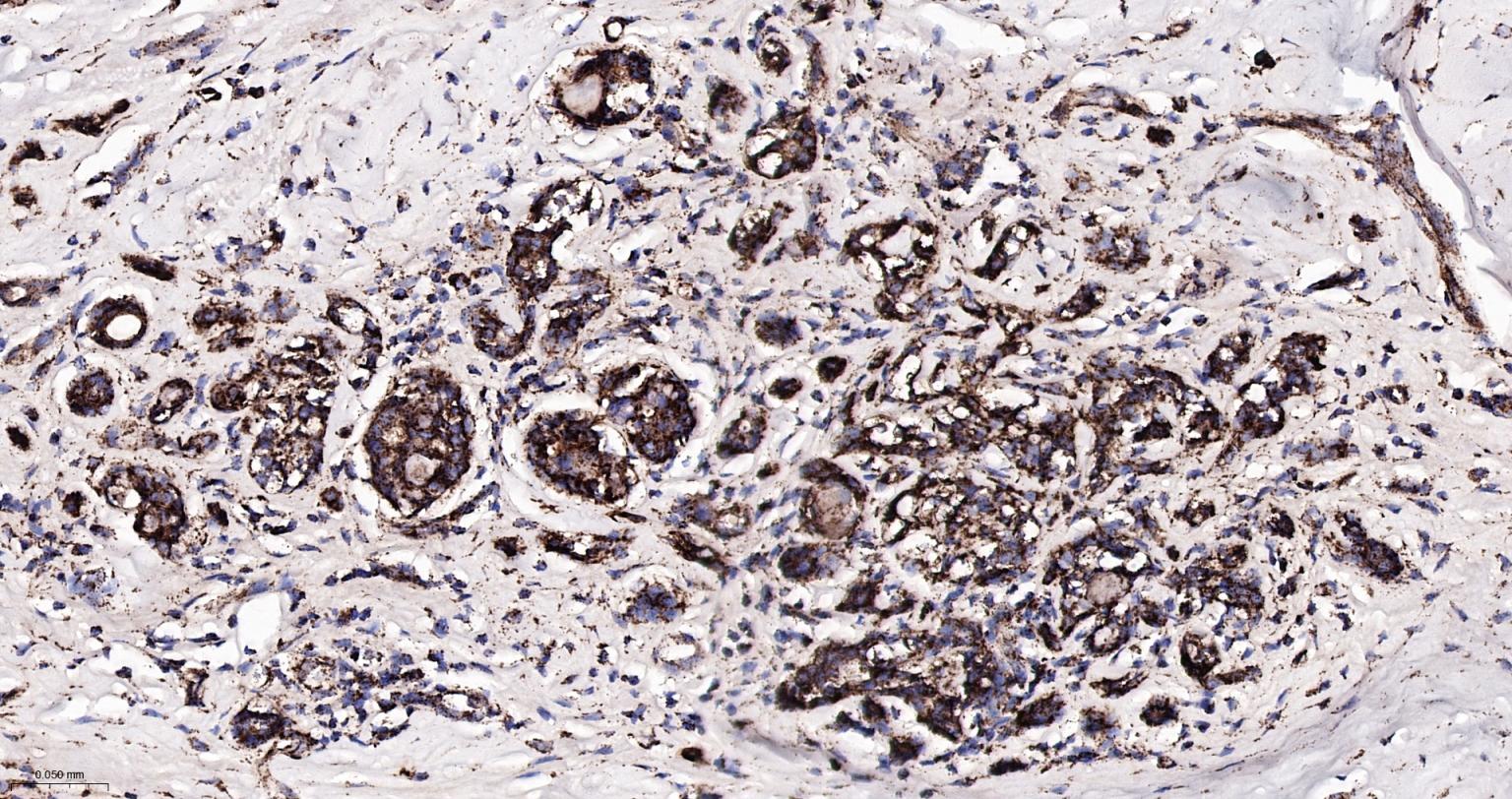 热休克蛋白-60/groEL重组兔单抗