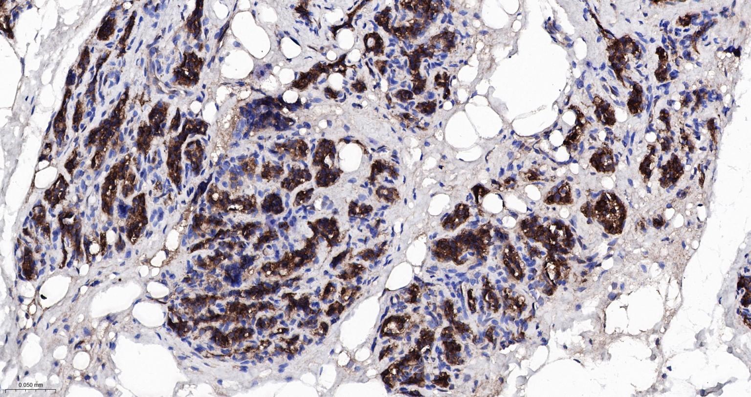 细胞核因子/k基因结合核因子重组兔单抗