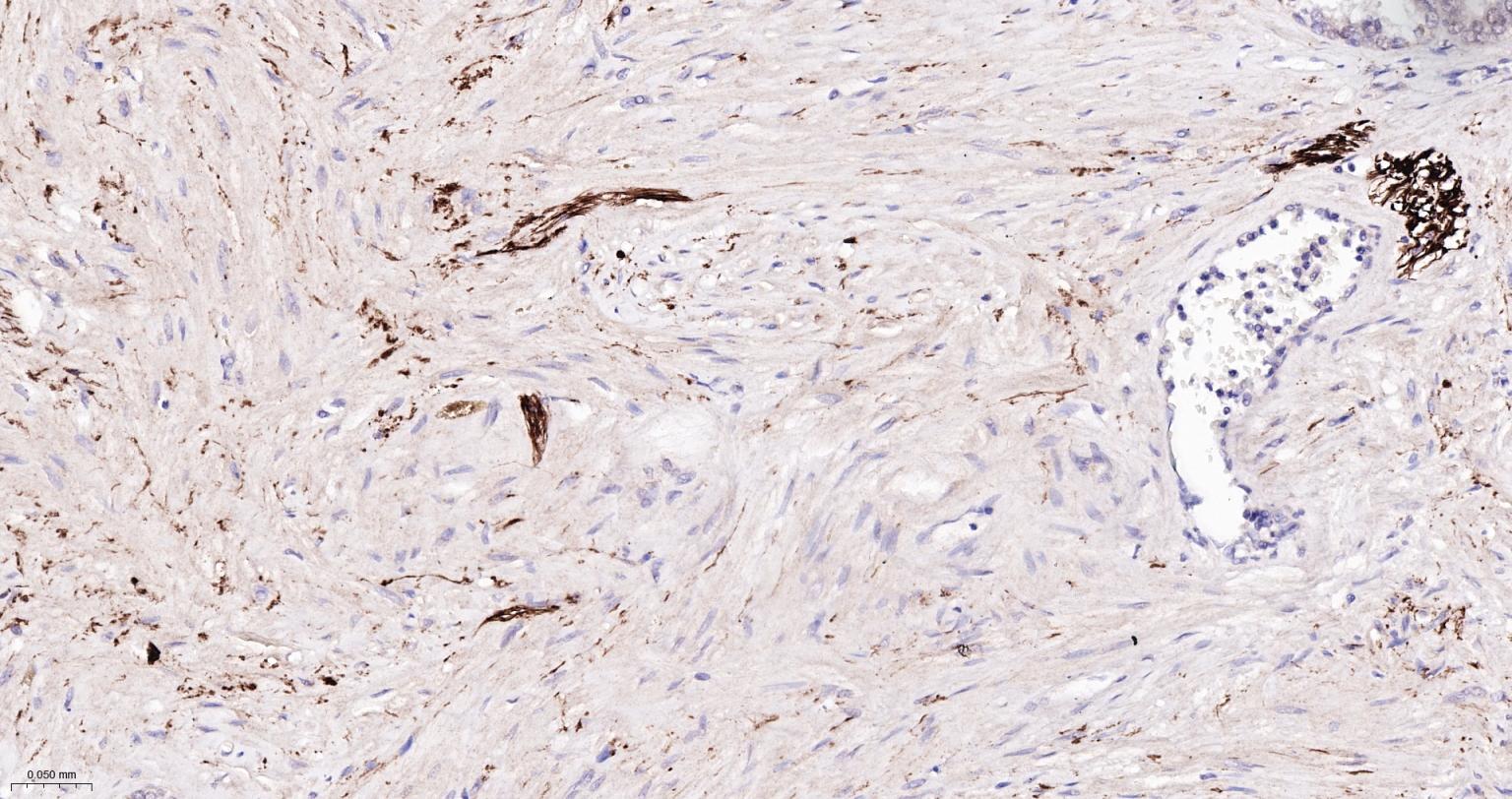 酪氨酸羟化酶兔单克隆抗体
