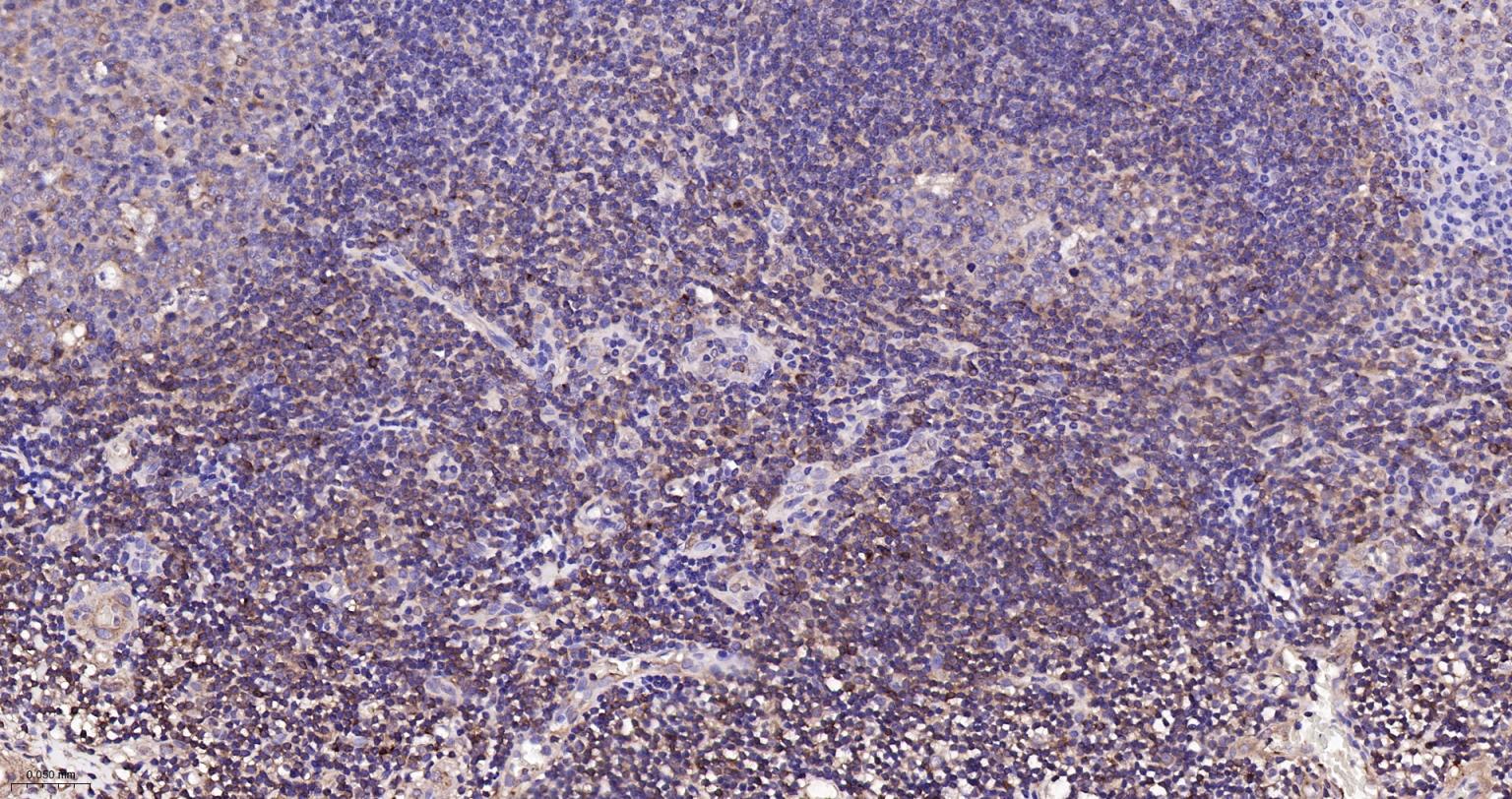 细胞核因子/k基因结合核因子重组兔单抗