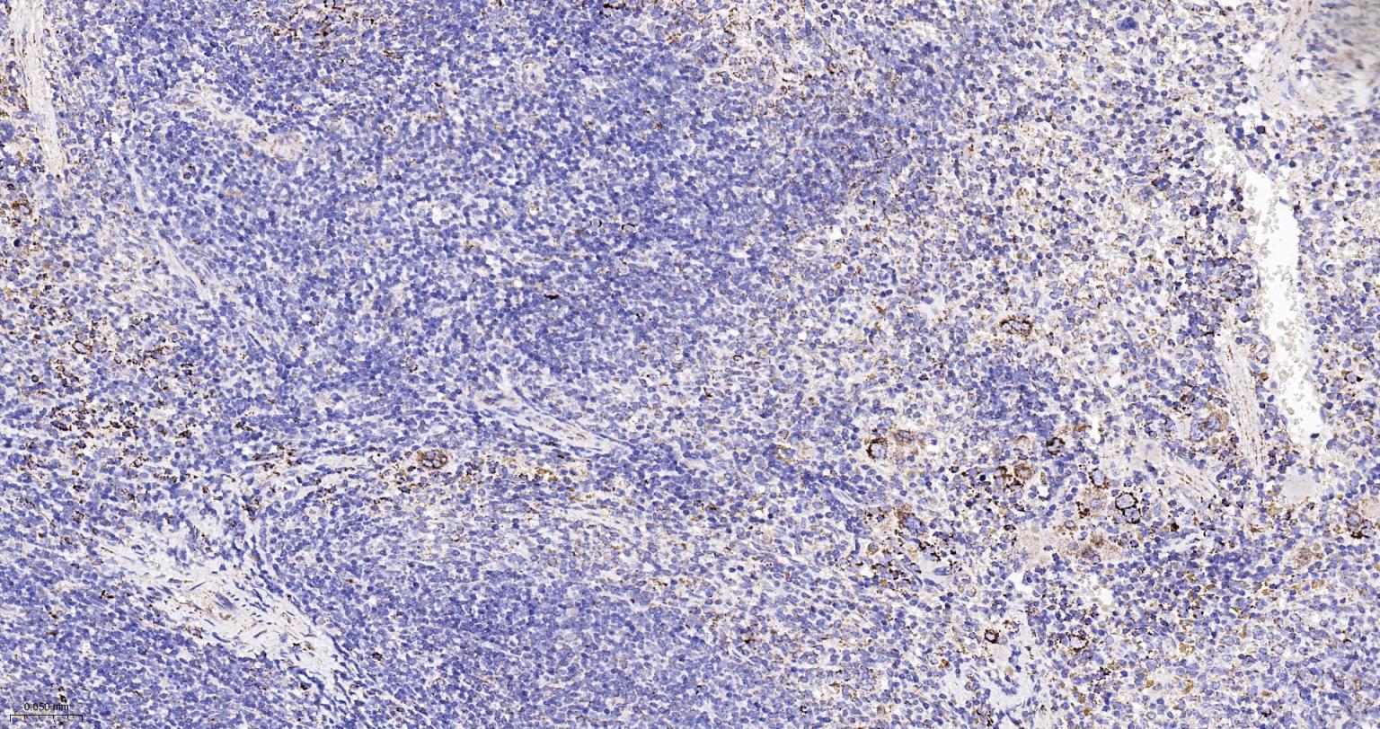 热休克蛋白-60/groEL重组兔单抗