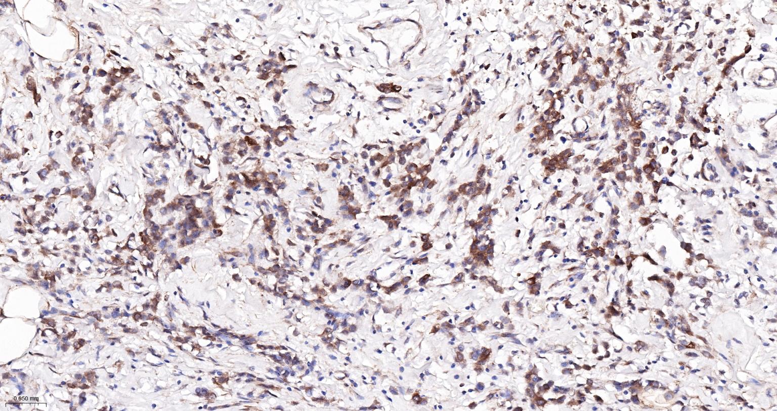 细胞核因子/k基因结合核因子重组兔单抗