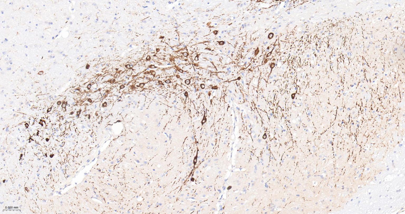 酪氨酸羟化酶兔单克隆抗体