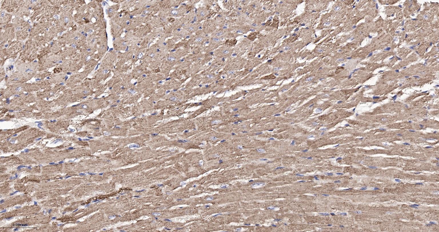 热休克蛋白-60/groEL重组兔单抗