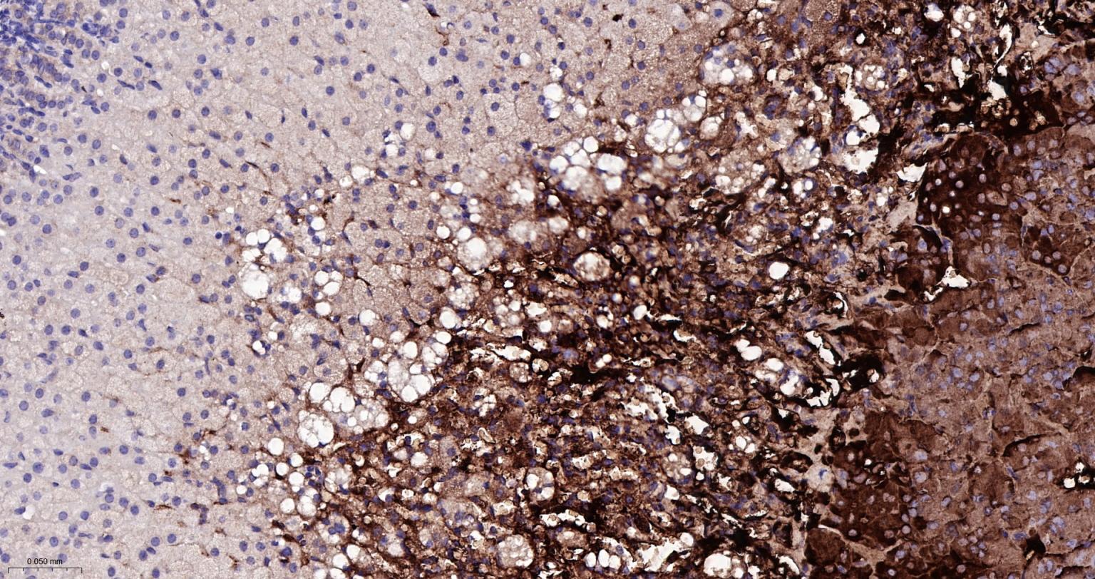 酪氨酸羟化酶兔单克隆抗体