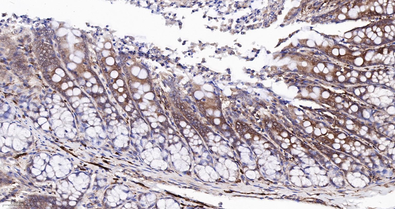 细胞核因子/k基因结合核因子重组兔单抗