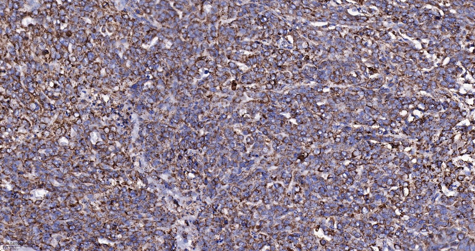 热休克蛋白-60/groEL重组兔单抗