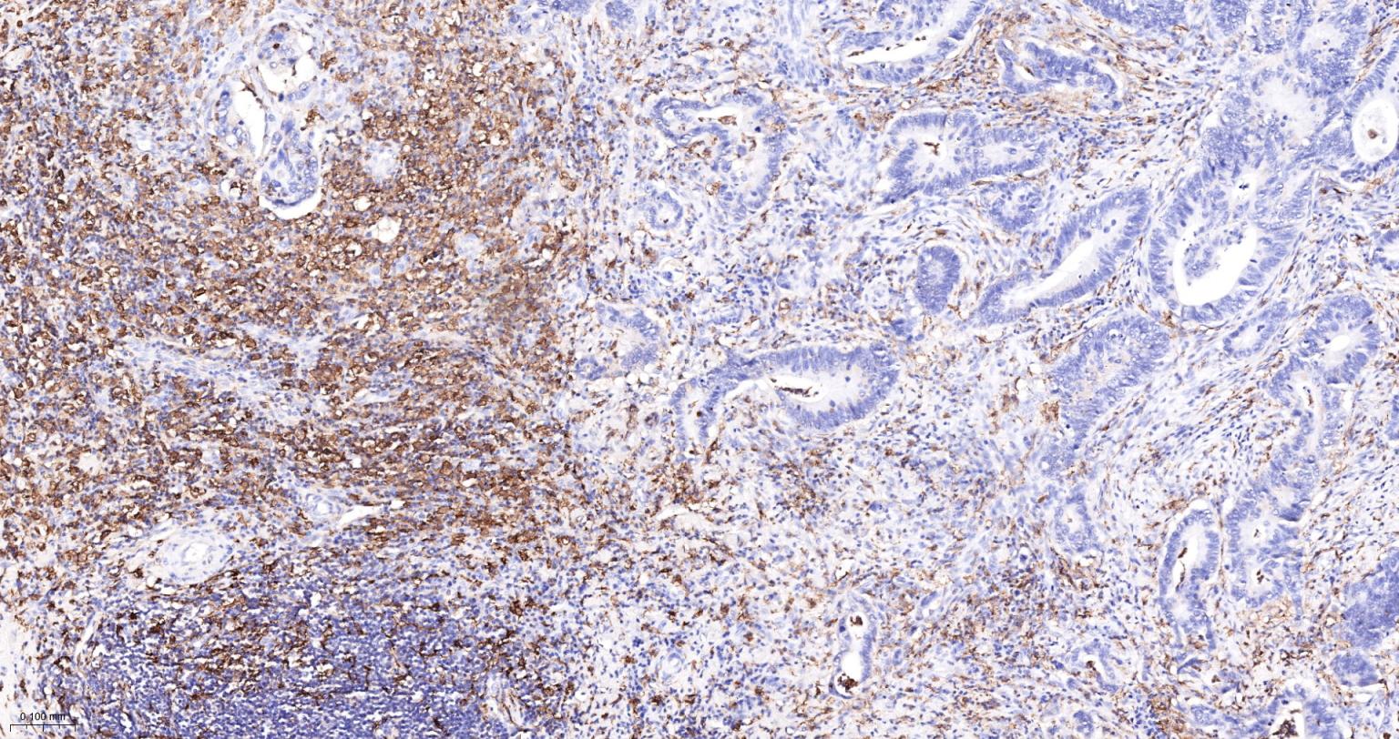 离子钙接头蛋白单克隆抗体-bsm-54132R