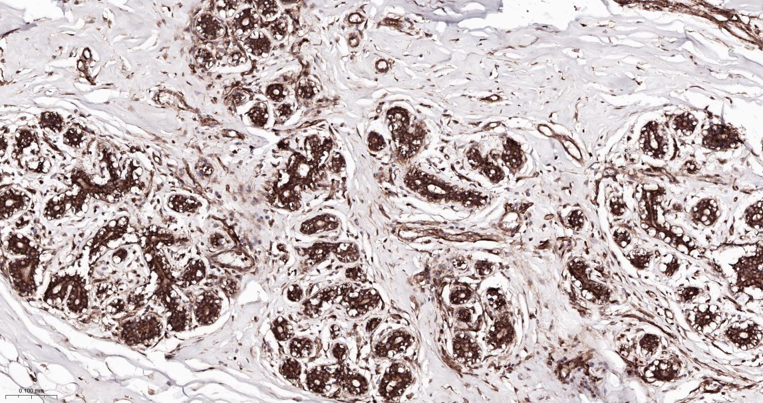 细胞核因子/k基因结合核因子重组兔单抗