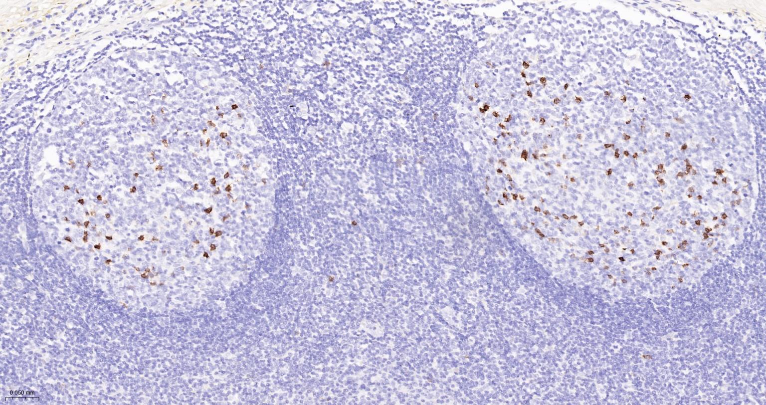 CD57 Mouse mAb (一抗) - IHC-P,IHC-F,IF | Bioss