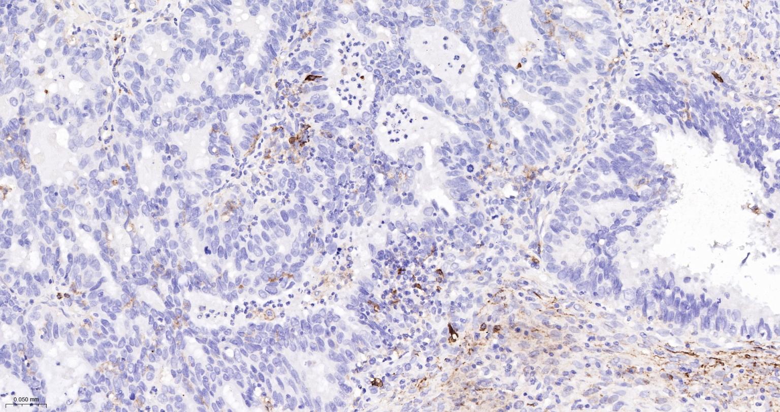 整合素αX重组兔单抗