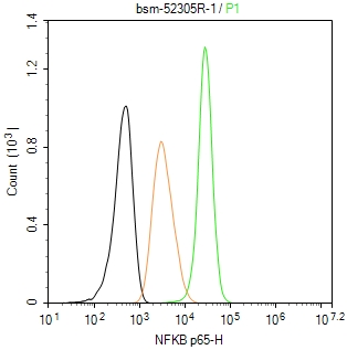 细胞核因子/k基因结合核因子重组兔单抗