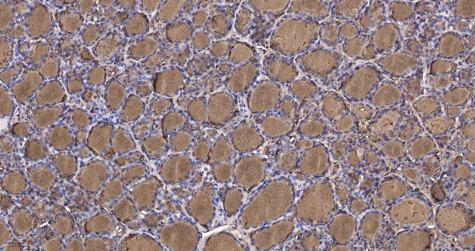 甲状腺球蛋白重组兔单抗