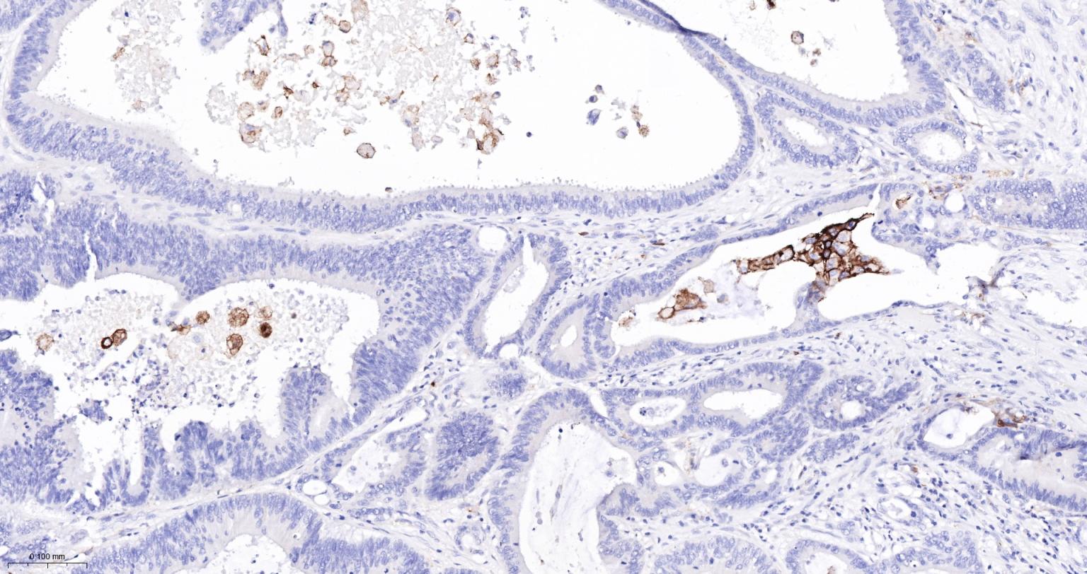 整合素αX重组兔单抗