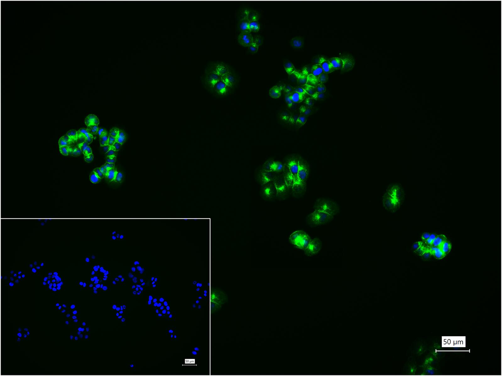 粘蛋白-1重组兔单抗