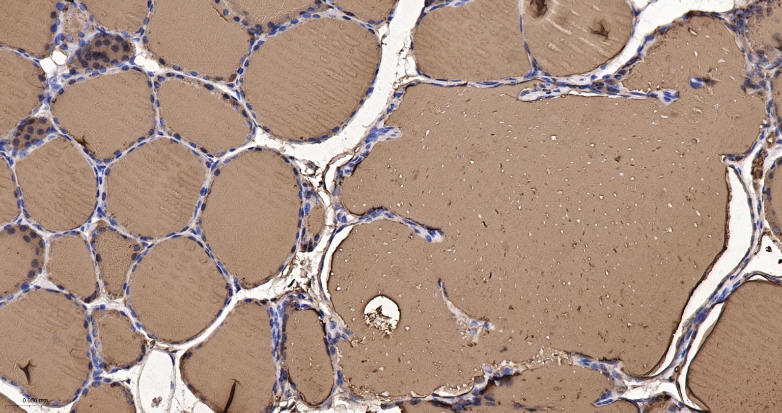 甲状腺球蛋白重组兔单抗