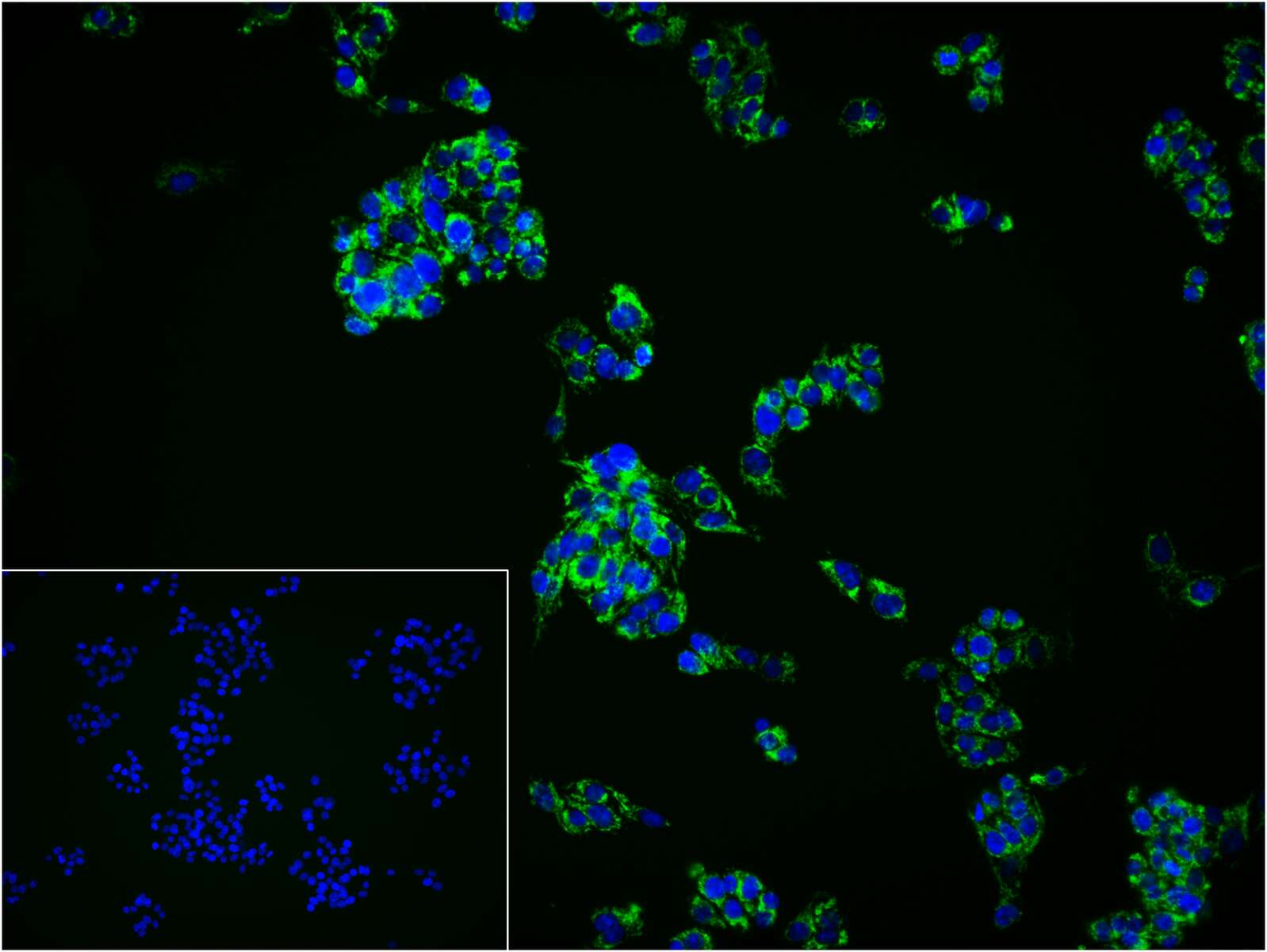 线粒体外膜受体Tom20抗体-bs-7357R
