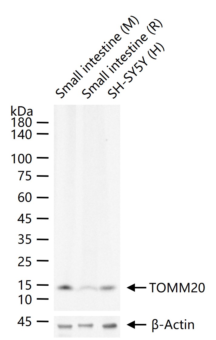 TOMM20 Rabbit pAb (一抗) - WB,IHC-P,IHC-F,IF,Flow-Cyt,ICC/IF | Bioss
