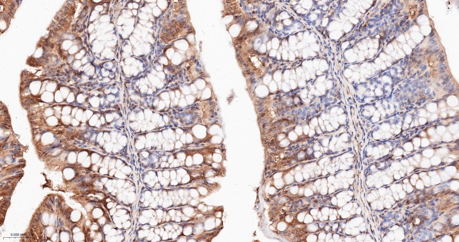 热休克蛋白90α重组兔单抗