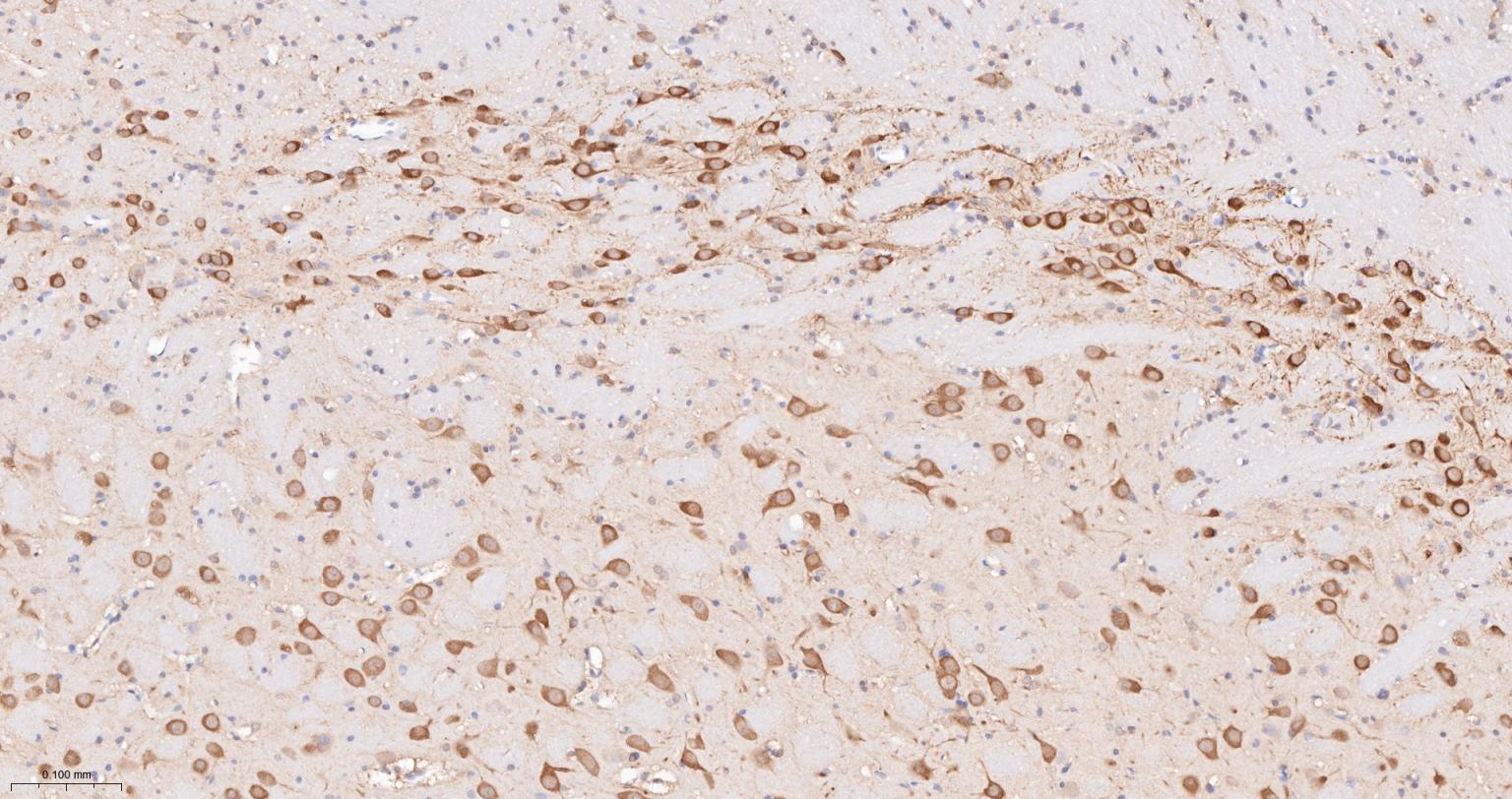 热休克蛋白90α重组兔单抗