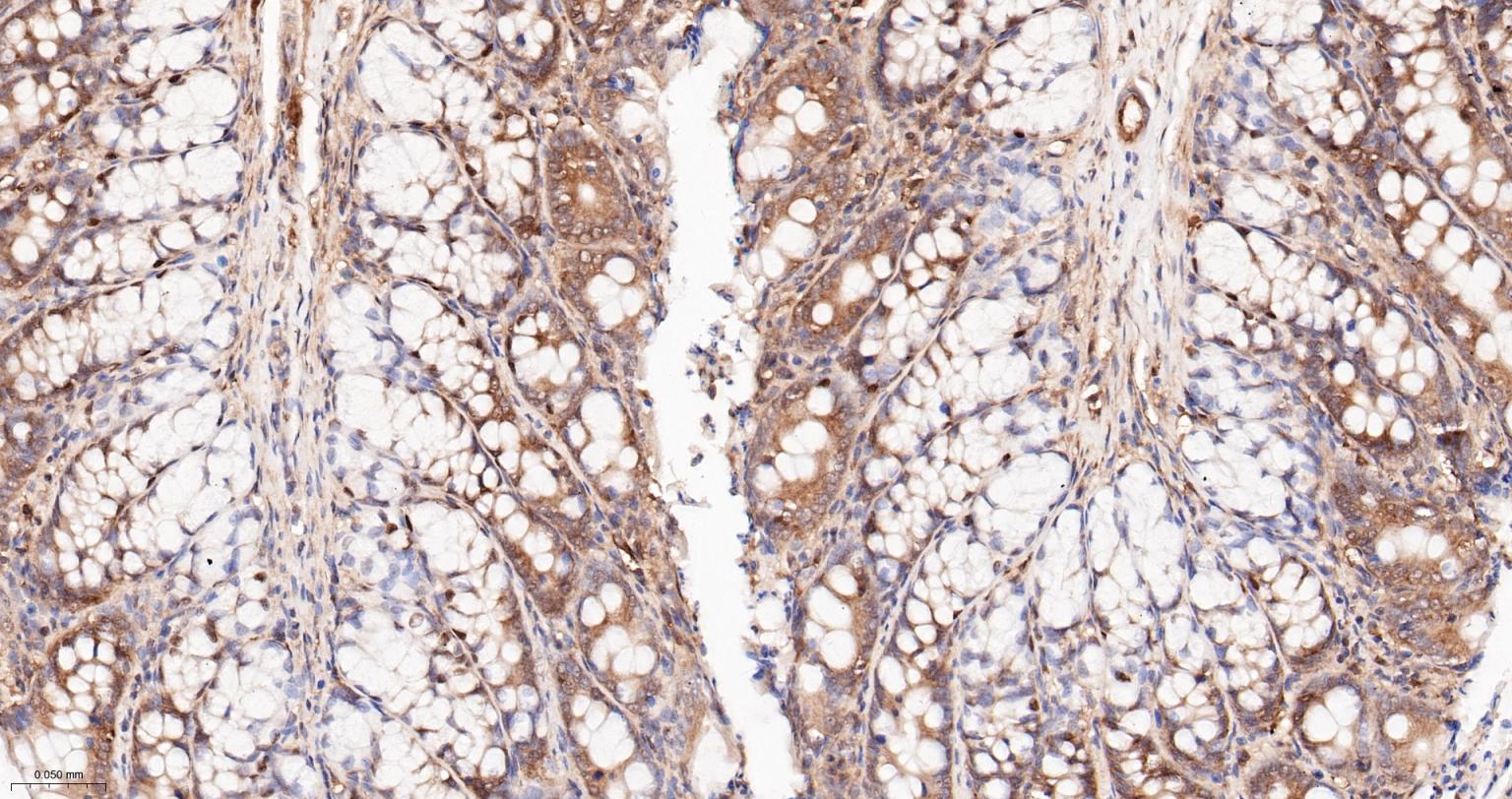 热休克蛋白90α重组兔单抗
