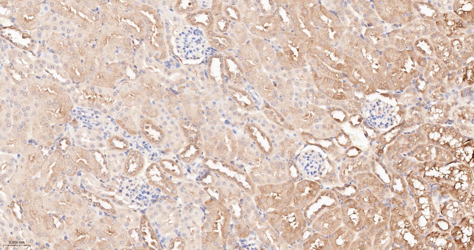 热休克蛋白90α重组兔单抗