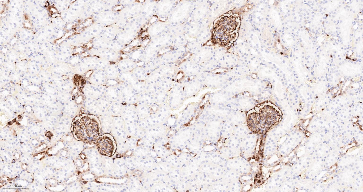 S100钙结合蛋白A6重组兔单抗