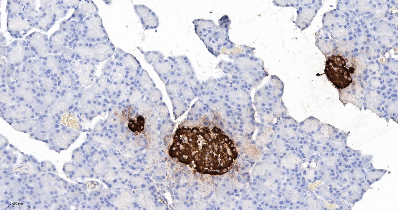 胰岛素重组兔单抗