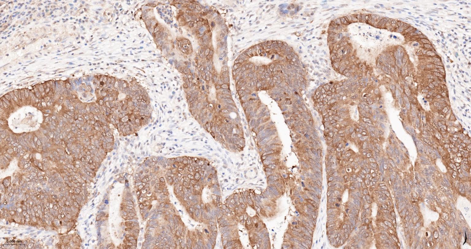 热休克蛋白90α重组兔单抗