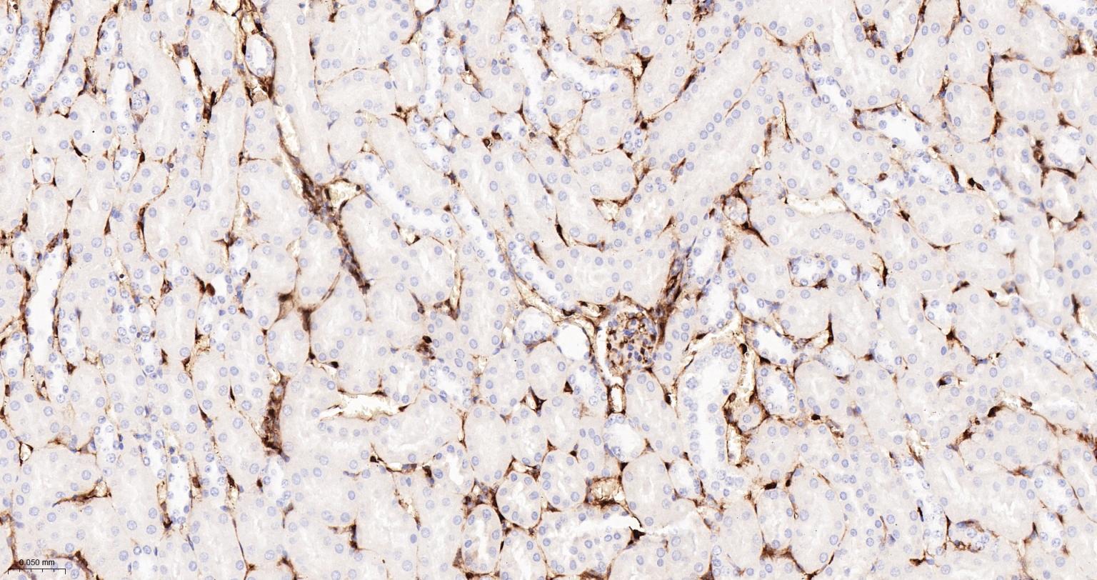 S100钙结合蛋白A6重组兔单抗