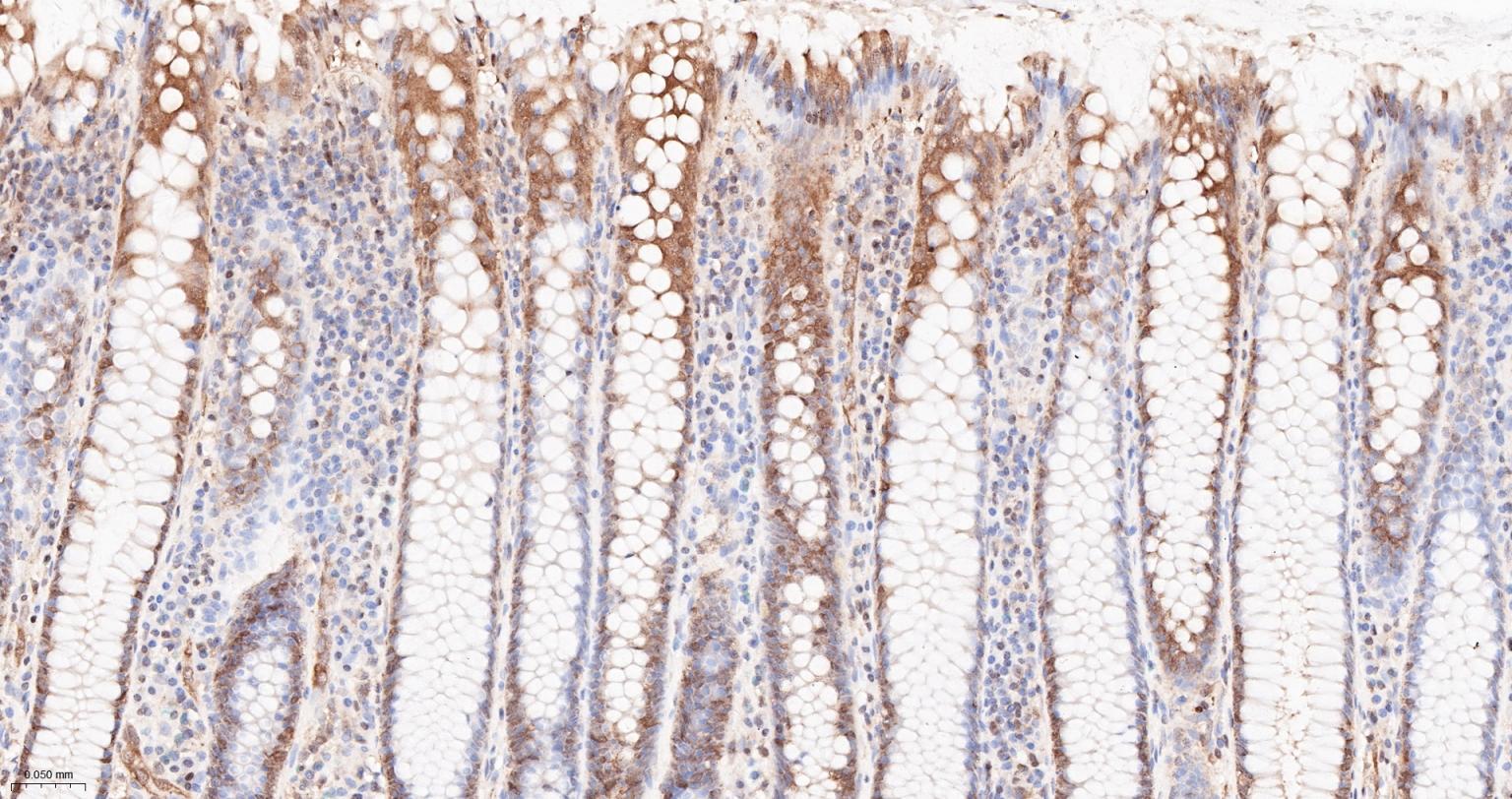 热休克蛋白90α重组兔单抗