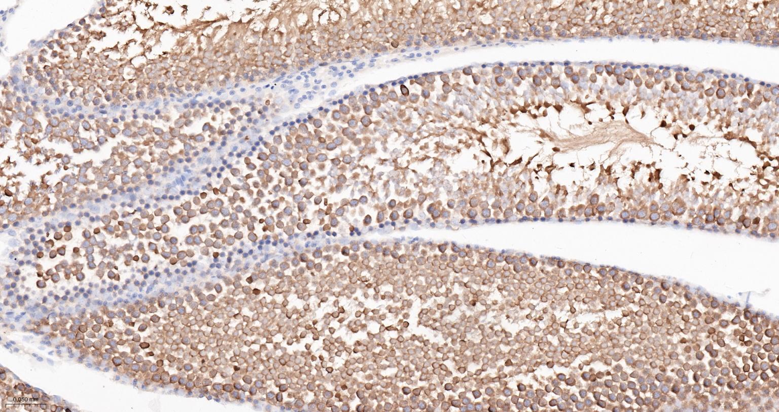 热休克蛋白90α重组兔单抗