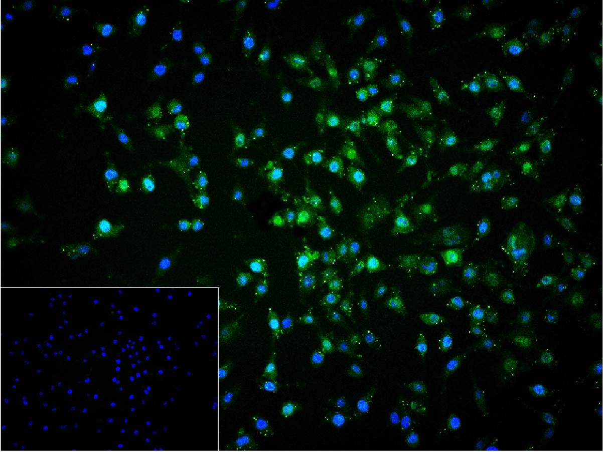 磷酸化丝裂原活化蛋白激酶1/2抗体-bs-3016R