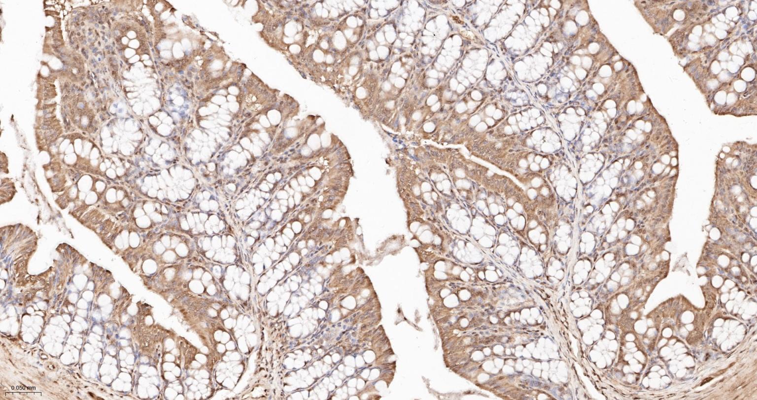 泛素蛋白重组兔单抗