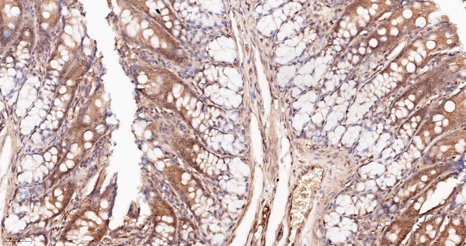 泛素蛋白重组兔单抗