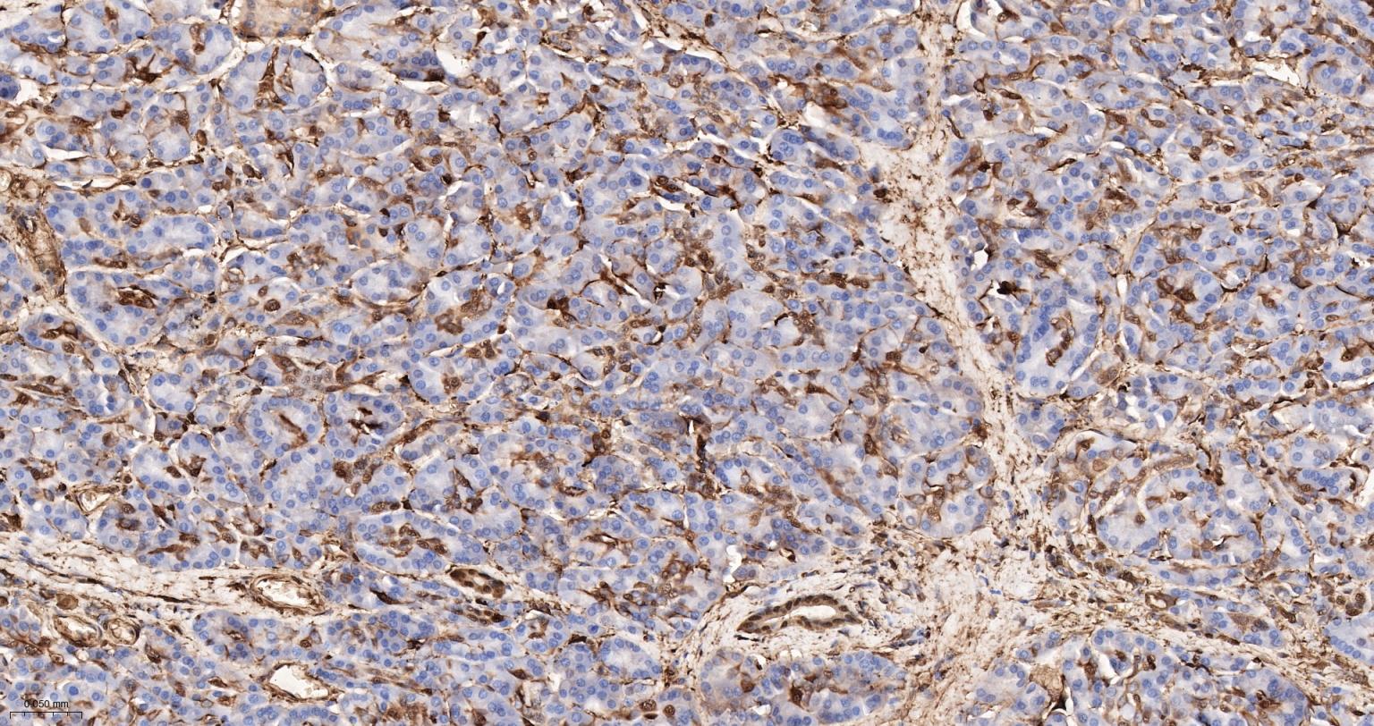 S100钙结合蛋白A6重组兔单抗